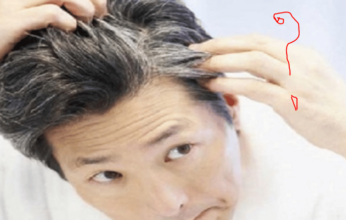 According to experts, it is definitely a cause for concern if hair starts to turn gray at a young age without any age-related cause. Our body has millions of hair follicles. It plays an important role in hair growth and maintaining hair color. Pigment cells contain a substance called melanin. It works to maintain hair color. As the pigment cells are destroyed with age, the hair begins to fall.