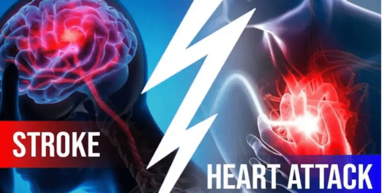 Stroke Heart and attack - two words of fear. These are two complex diseases of human life. Which bring life to a standstill.