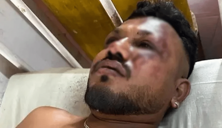 ভারতের গুজরাট রাজ্যের আহমেদাবাদে বিধ্বস্ত উড়োজাহাজের এক যাত্রী বেঁচে আছেন। পুলিশ তাকে খুঁজে পেয়েছে। ফ্লাইটের ১১এ