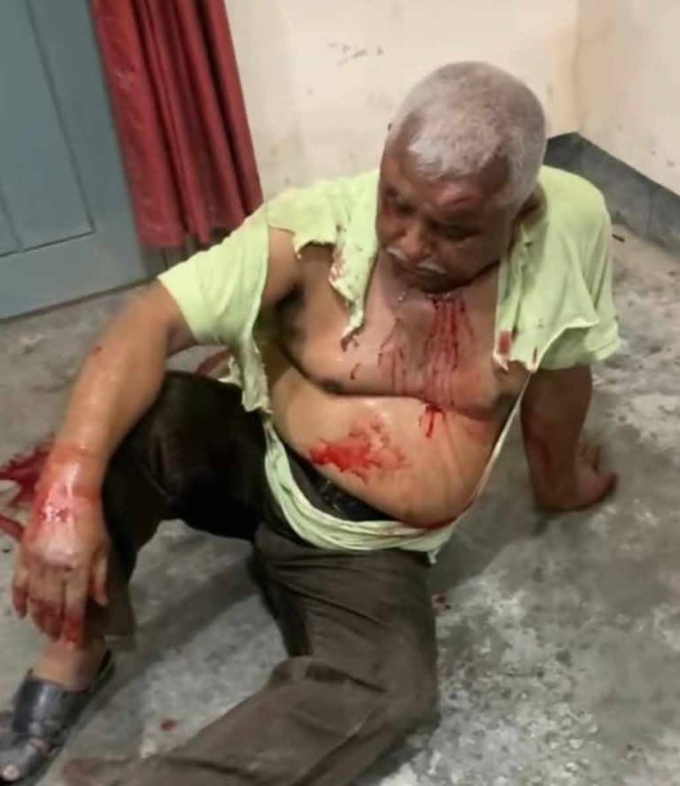 রাজবাড়ীর বালিয়াকান্দিতে নবী করিম (সা.) সম্পর্কে কটুক্তির অভিযোগে কমিউনিটি মেডিকেল অফিসার (অবঃ) ডা. আহম্মদ আলীকে গণপিটুনি দিয়েছে জনতা। খবর পেয়ে